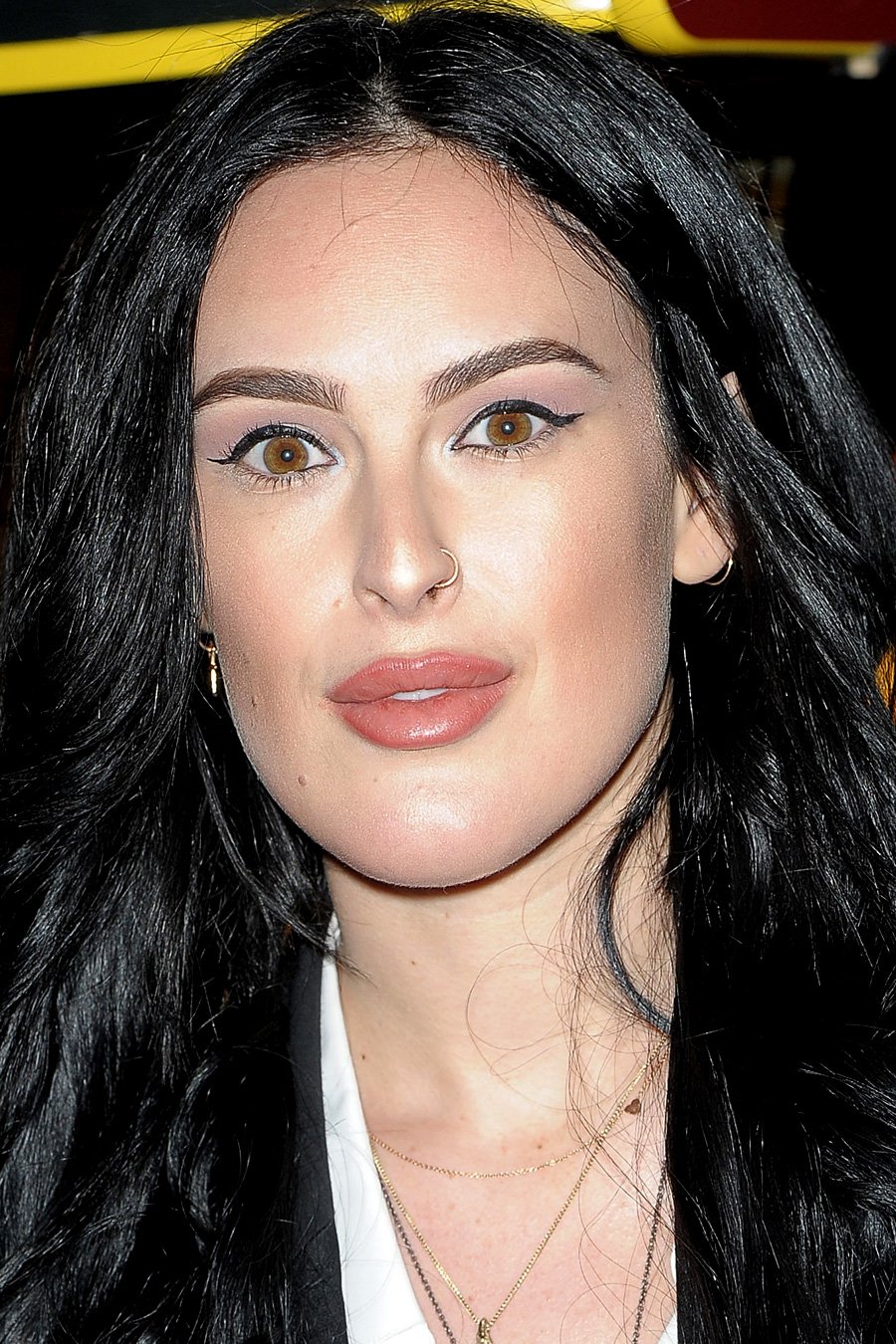Rumer Willis Schönheits-OP
