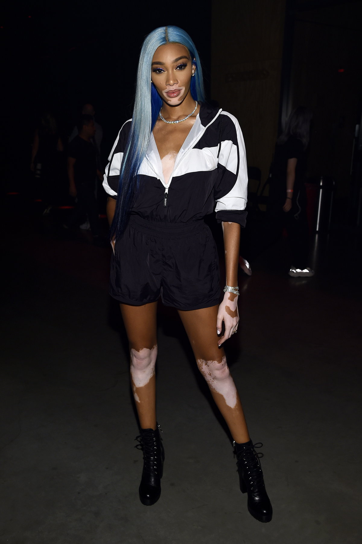 Winnie Harlow