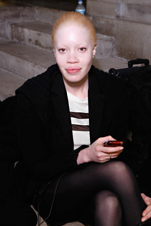 Diandra Forrest: Albino-Model