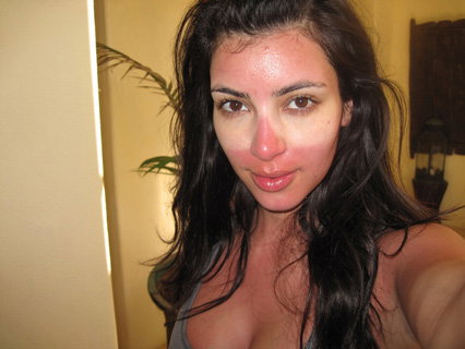 Twitpic Kim Kardashian mit Sonnenbrand