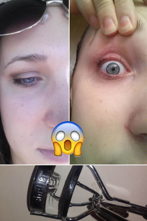 Verheerender Beauty-Unfall!