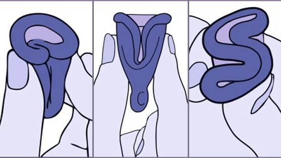 menstruationstasse-einfuehren-1916461.jpg