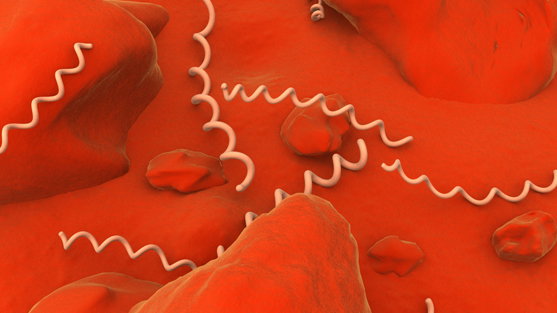 syphilis-875384.jpg
