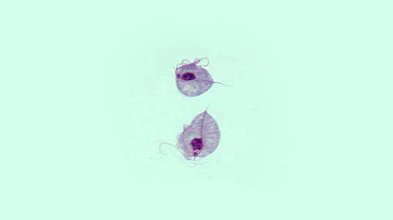 geschlechtskrankheiten-trichomonadiasis-875384.jpg