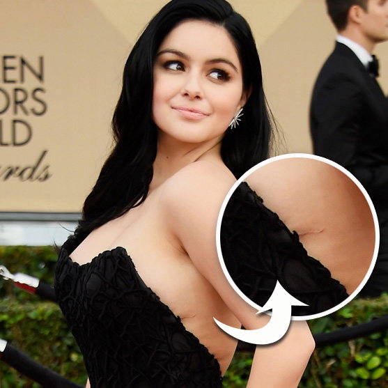 ariel-winter-brust-narben-inline-2075785.jpg