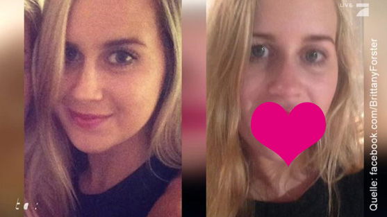 Lip Plumber: Australierin will Lippen wie Kylie Jenner