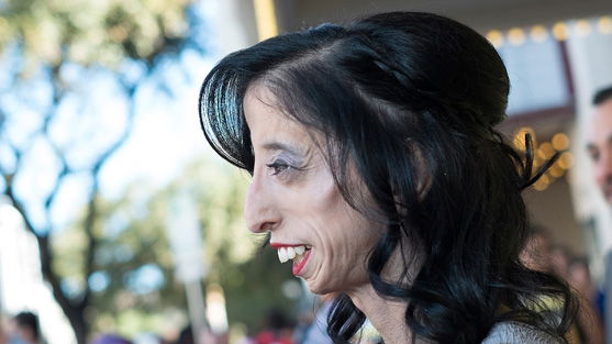 Lizzie Velasquez: Die mutigste Frau der Welt