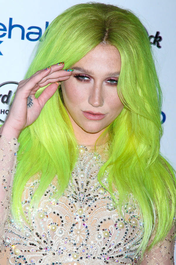 Kesha: Neon-grüne Haare