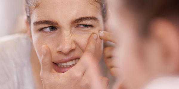 Hello, makellose Haut: Mit diesem Tool entfernst du alle Mitesser im Handumdrehen!