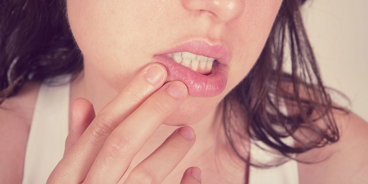 Tipps & Tricks bei Lippenherpes!