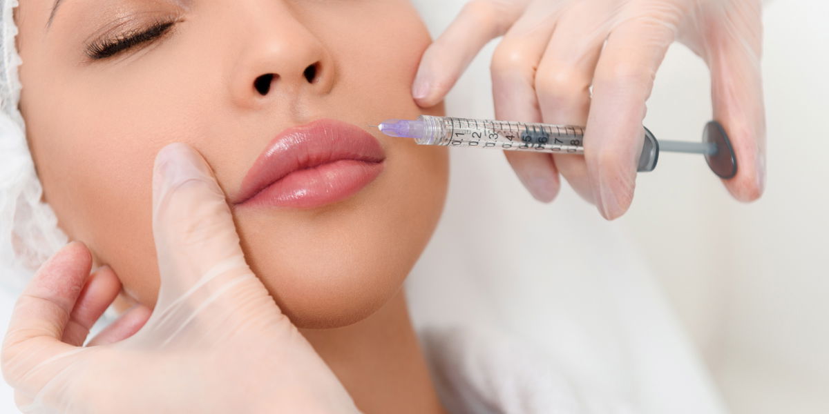Lippen aufspritzen: Durch Kylie Jenner beliebt wie nie