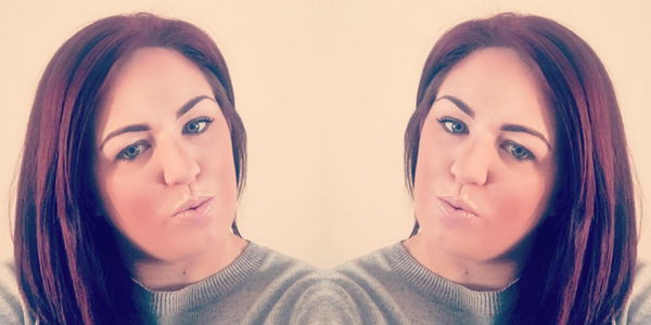 Kirsty Weston: Haare und Kopfhaut nach Haare bleichen verbrannt  