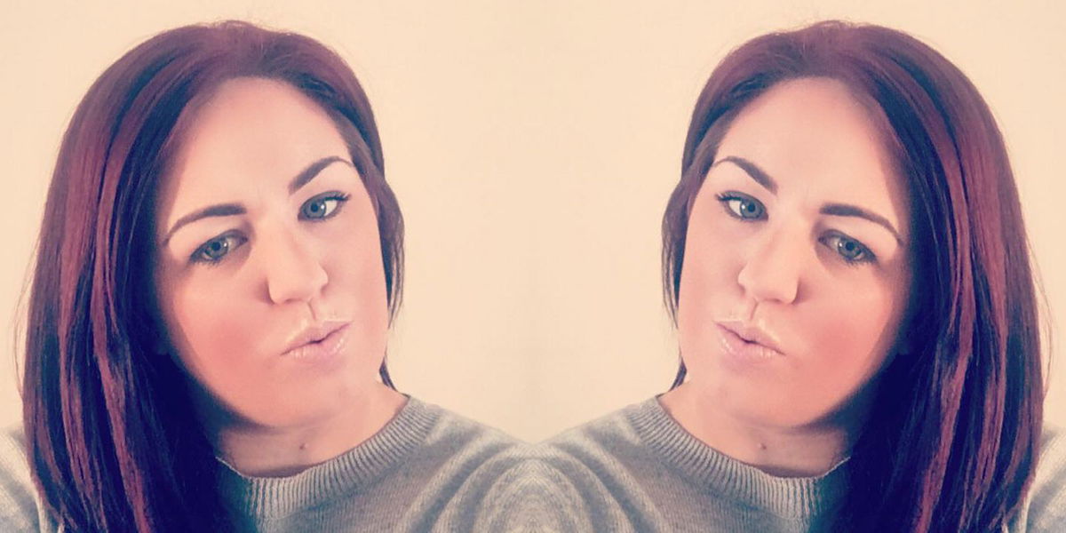 Kirsty Weston: Haare und Kopfhaut nach Haare bleichen verbrannt