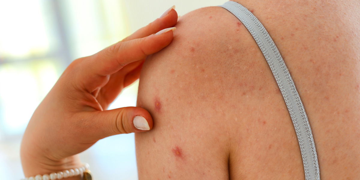 „Skinpositivity“: Der neue Körper- und Wohlfühltrend