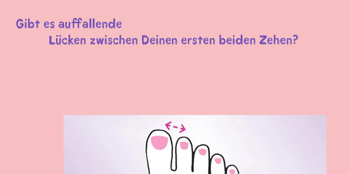 lücken zehen