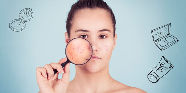 Acne inversa: Das wünschst Du nicht mal Deinem größten Feind!