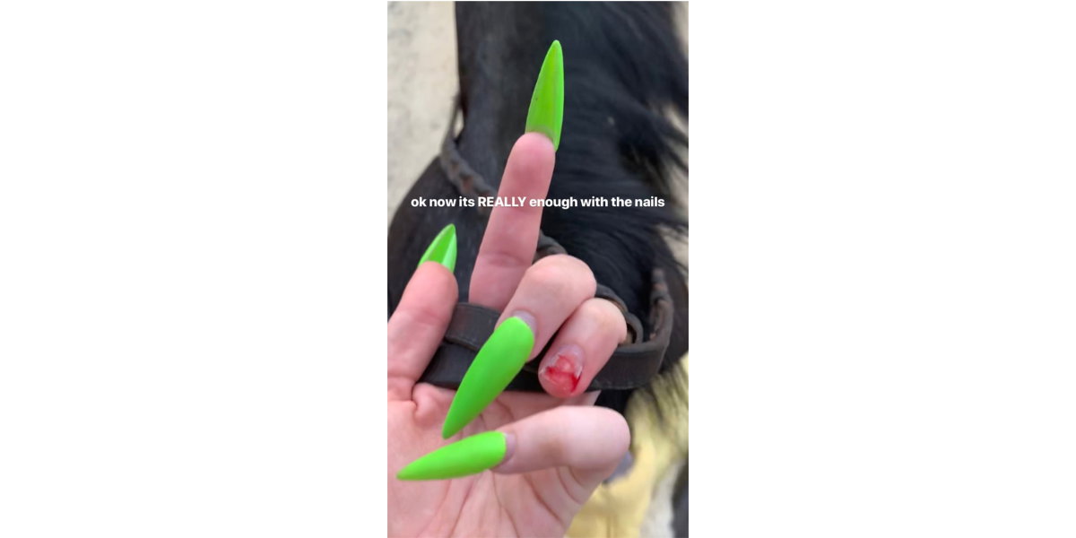 billie-eilish-fingernagel-story